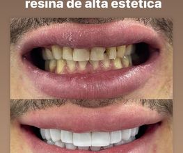 236747093-1-cf9bMQChLw1736935322224.jpeg
