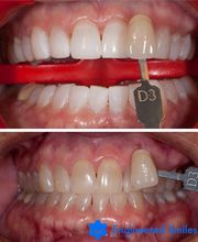 Providence Dental Spa | East Cobb image 9