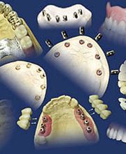 Schmelz + Vatter Zahntechnisches Labor GmbH Bild 1