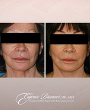 Eugenie Brunner, MD, FACS image 2
