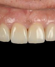 Clínica Dental Dres. Nuñez García imagen 8