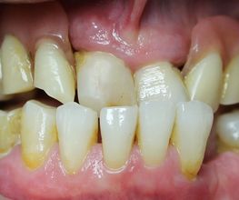 Clínica Implanteoral Milladoiro imagen 9
