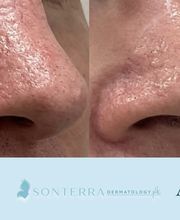 Sonterra Dermatology at The Pearl image 7