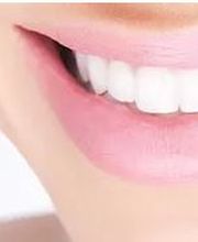 Bleaching - Dr. Renate Feimer München