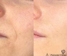 MS Lashes and Brows Bild 16