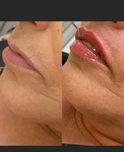 Estética Raphaela Santana imagen 9