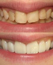 Future of Dentistry at Willows - North Andover image 1