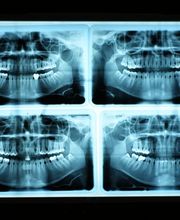 Dr. med. & med. dent Raphael Perren Bild 7