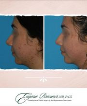 Eugenie Brunner, MD, FACS image 19