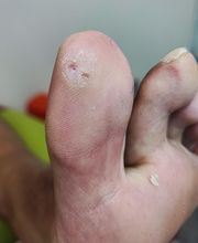 Podología clínica y deportiva Sureste imagen 3