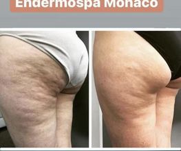 Endermospa image 2