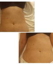 VitalmassageSevilla imagen 6