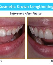 NYC Periodontics and Implant Dentistry: Scott O. Kissel, DMD, PC image 5