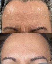 PureBeautyNP Aesthetics image 7