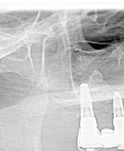 Bodensee Implantatzentrum Dr. Wolfgang Prinz MDSc Zahnarzt/ Implantologie Bild 2