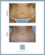 Charles A Wallace, MD image 12