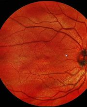 Optik Scheffer Essen