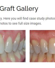 NYC Periodontics and Implant Dentistry: Scott O. Kissel, DMD, PC image 4
