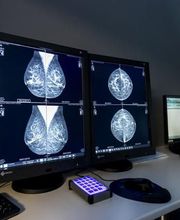 CRTT image 11
