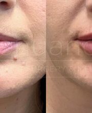 Renuance Cosmetic Surgery and MedSpa image 7