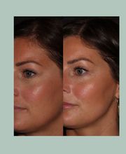 MaineStay Skincare image 13