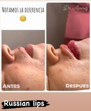 Theys Belleza imagen 6