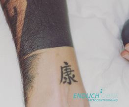 ENDLICH OHNE Tattooentfernung Filiale Fulda Bild 2