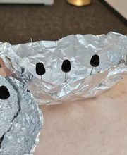 Oase TCM | Akupunktur, Chinesische Medizin für Baselland und Basel Bild 5