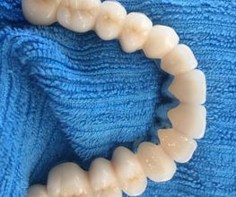 Dentaltechnik Oriwal Bild 6