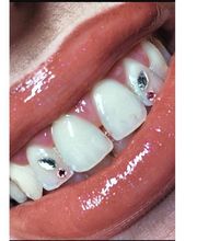 Beautycel image 1