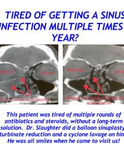 Sinus & Snoring Specialists image 10
