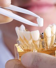 Moreland Family Dentistry image 8