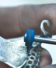 Dentallabor Vill & Hapke GmbH Bild 1