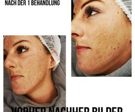 Wimpernwerk Eickel Bild 7