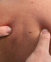 Vermont Mourichon Charlotte image 2