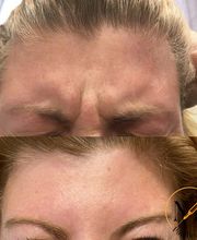 PureBeautyNP Aesthetics image 5