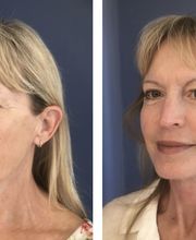 Daniel Golshani, MD, FACS image 6