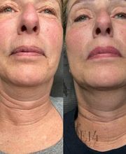 Elle 14 Ink Studio image 4