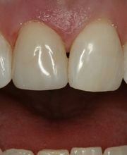 TERAN Dental Co. image 20