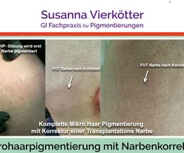 Microhaar Pigmentierung 061