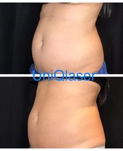 UniQ Laser Center Watertown image 3