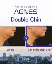 MEDILASE Lasers Médicaux et Photonique Médicale image 18