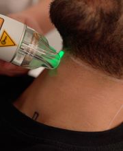 Dauerhafte Haarentfernung - Remove Laserzentrum Stuttgart Bild 5