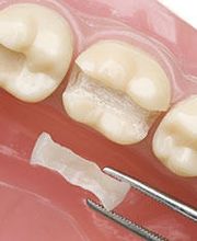 Neric Médecine dentaire I Zahnmedizin Bild 3