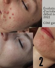 Centre Kératoconseil image 13