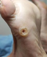 Podología clínica y deportiva Sureste imagen 7