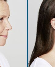 Lift Aesthetics image 7