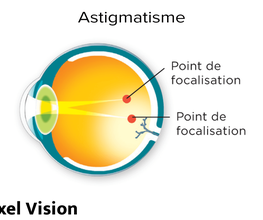 Aixel Vision image 3