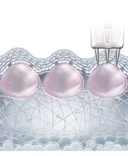 Lignon Esthétique - Institut de Beauté Bild 4