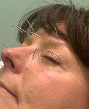 Far Hills Acupuncture image 2